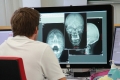 Spezialist schaut sich Schädel-Röntgenbilder am Bildschirm an